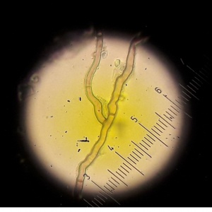 Rhizoctone sur gazon